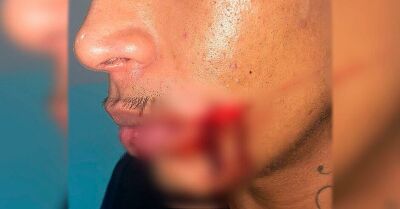 Imagem da notícia Servente de pedreiro é esfaqueado pelo patrão ao cobrar pagamento em Três Lagoas